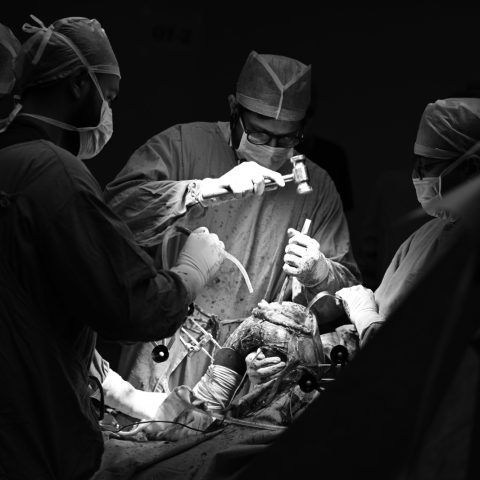 Da Vinci Surgical System